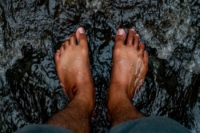 Understanding Hammertoe